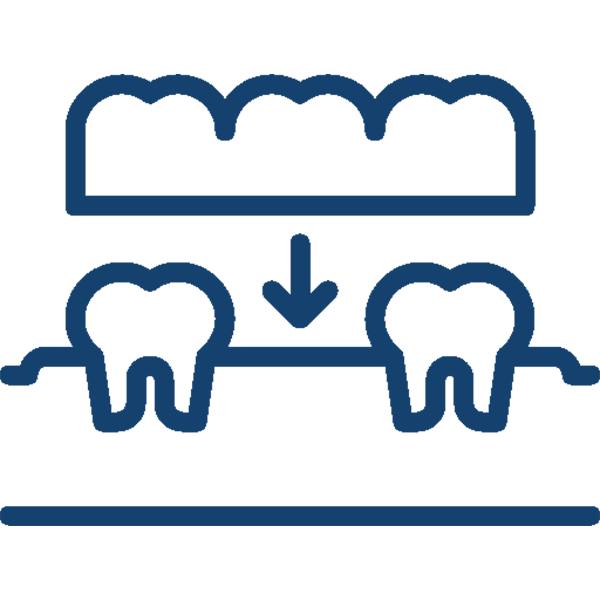 Dental Bridges
