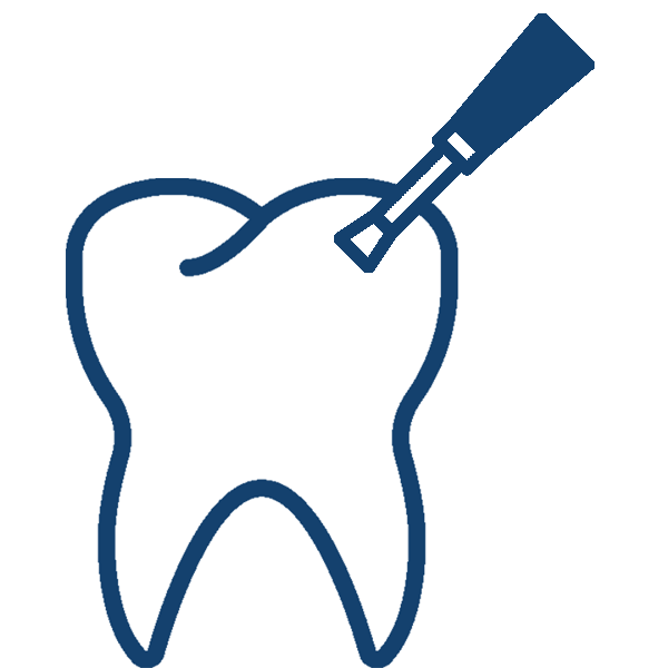 Dental Sealants